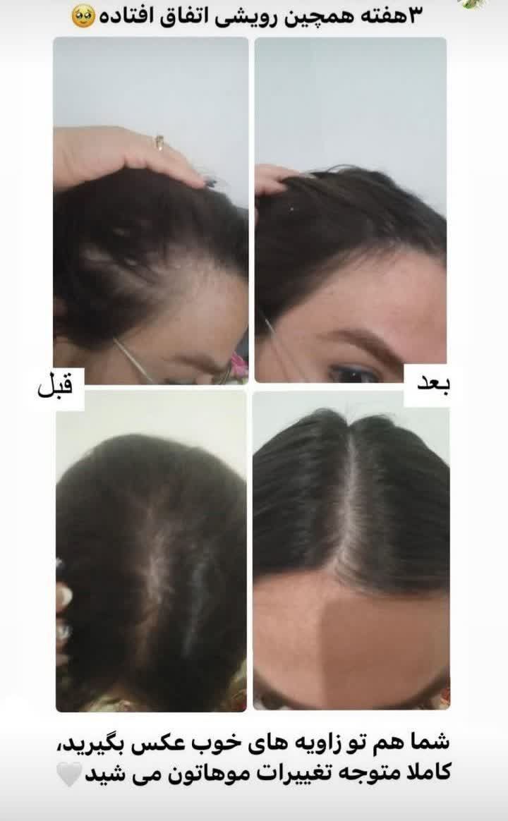 شامپو کافئین و روغن هسته انگور جلوگیری از ریزش مو برند دکتر بیز